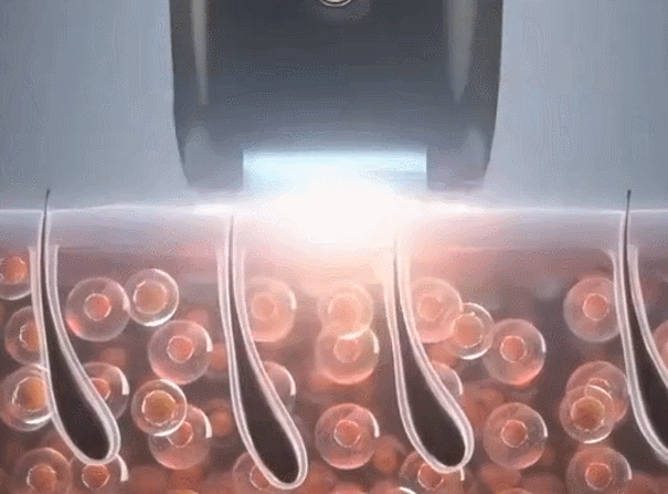 53ddd0a4f5dd4fb14a43bc38f7d2ef1c.gif